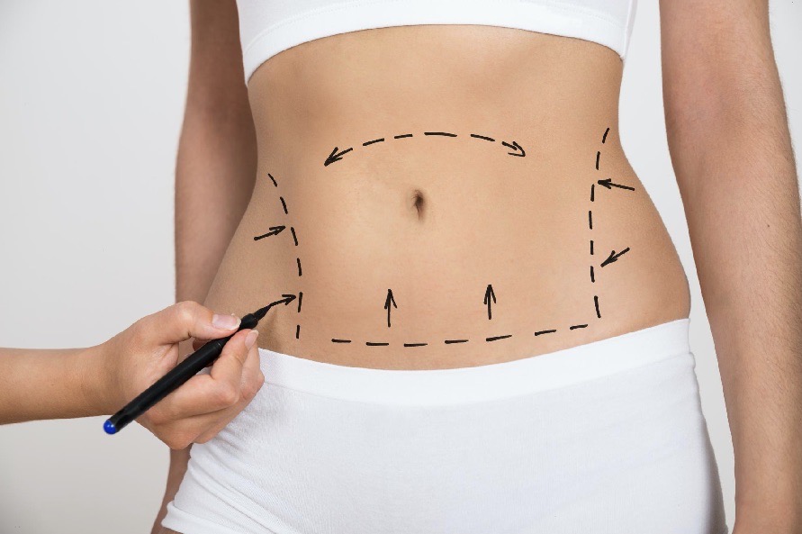 Doctor marking a patient