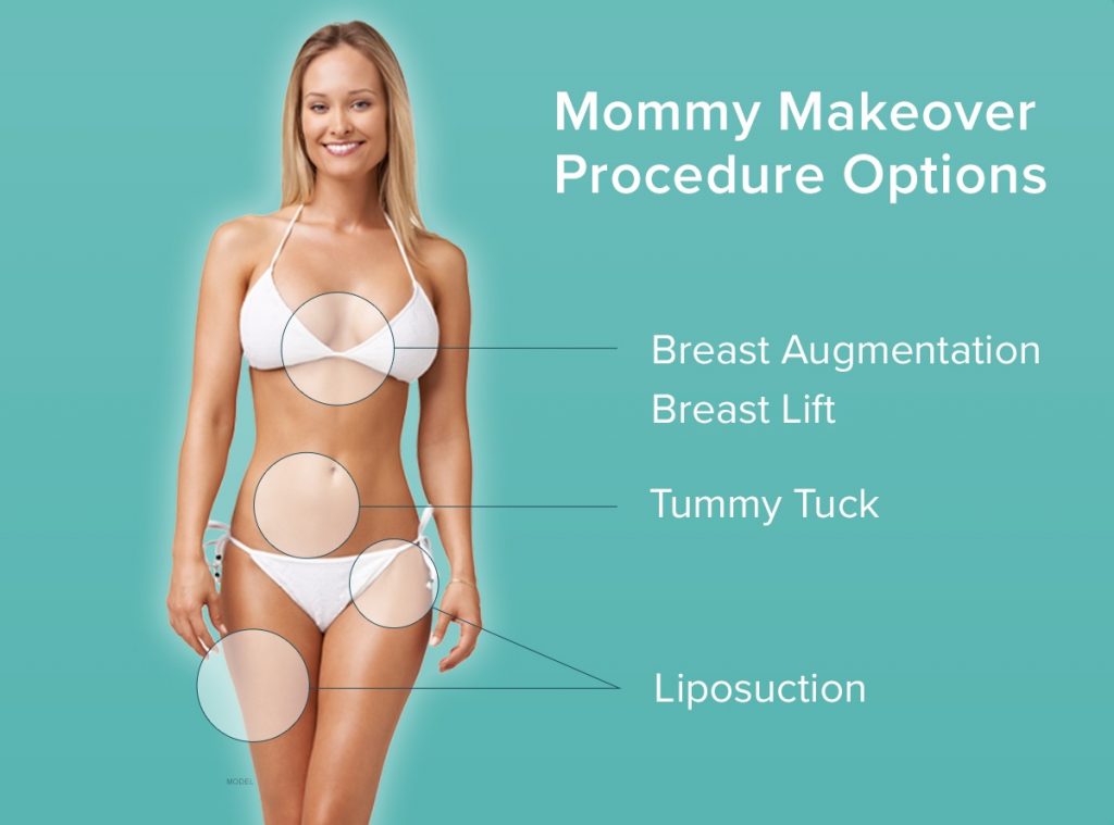 Mommy Makeover Procedure Options