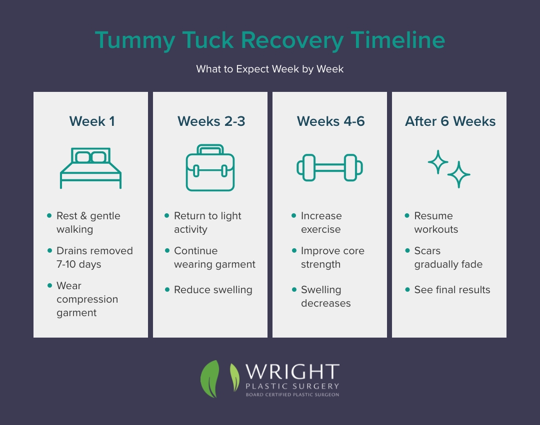 An infographic by Wright Plastic Surgery showing a four-step recovery timeline for a tummy tuck procedure. The timeline includes key milestones for rest, physical activity and expected results within weeks 1-6 and after. Icons and bulleted lists describe each phase.