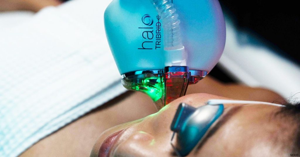 HALO® TRIBRID™ Laser Treatment. (Model)