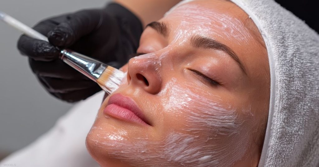 Model image of a chemical peel treatment